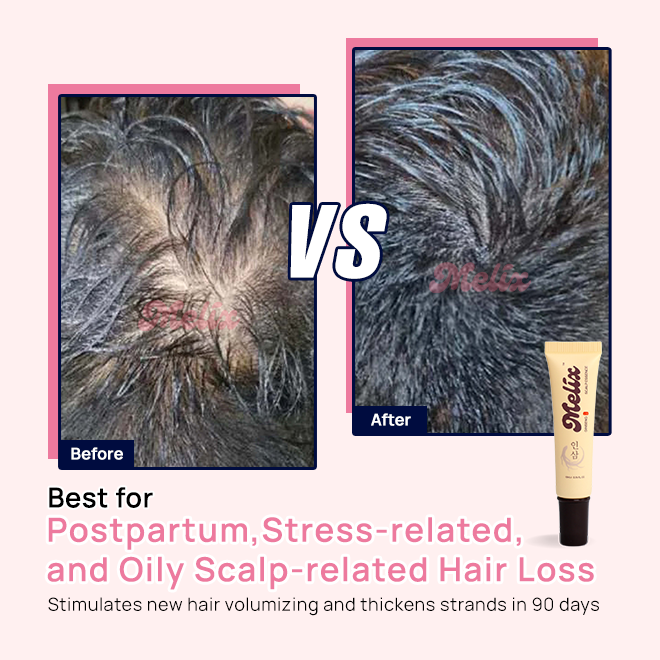 [Anti Hair-fall] 45ml Ginseng Scalp Essence