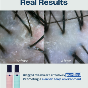 120ml PRIME 01: SoftPrep [For Oil Scalp](RM5 OFF)