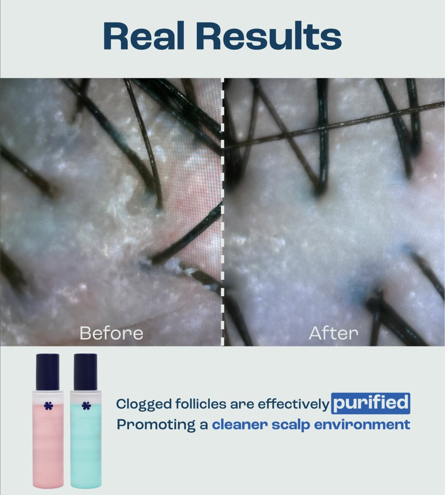 120ml PRIME 01: SoftPrep [For Oil Scalp](RM5 OFF)